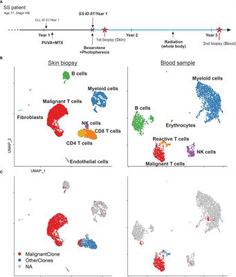 Phenotypic plasticity of malignant T cells in blood and skin of a Sézary syndrome patient revealed by single cell transcriptomics
